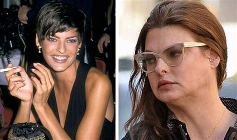 linda evangelista before and after surgery.